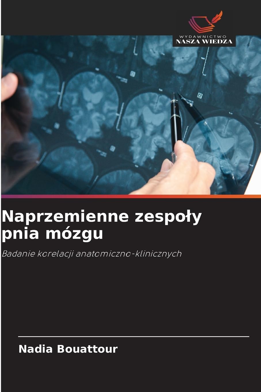 Naprzemienne zespo¿y pnia mózgu Medicine