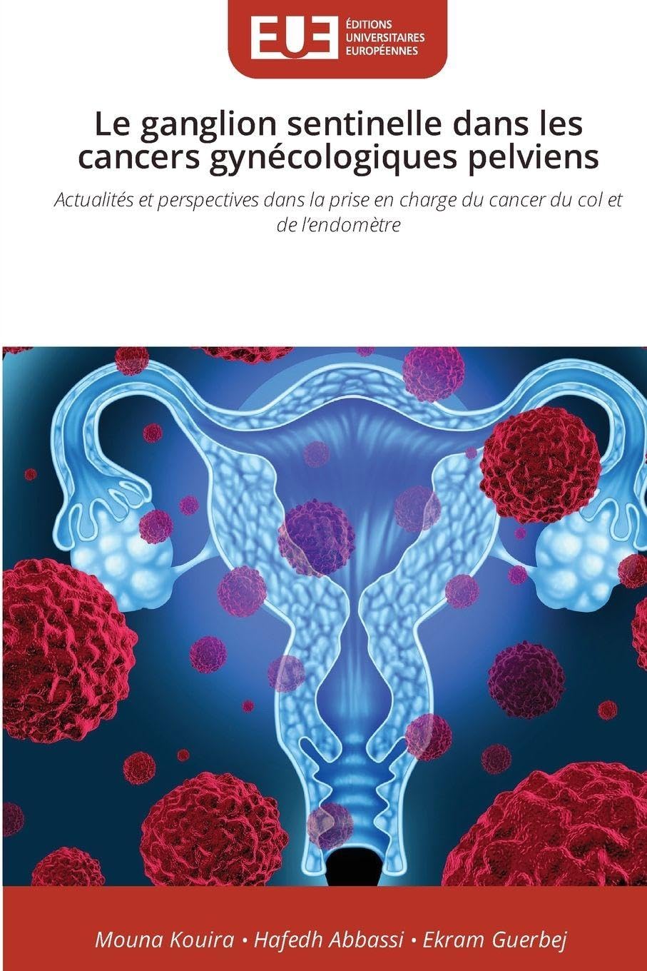 Le ganglion sentinelle dans les cancers gynécologiques pelviens Medicine