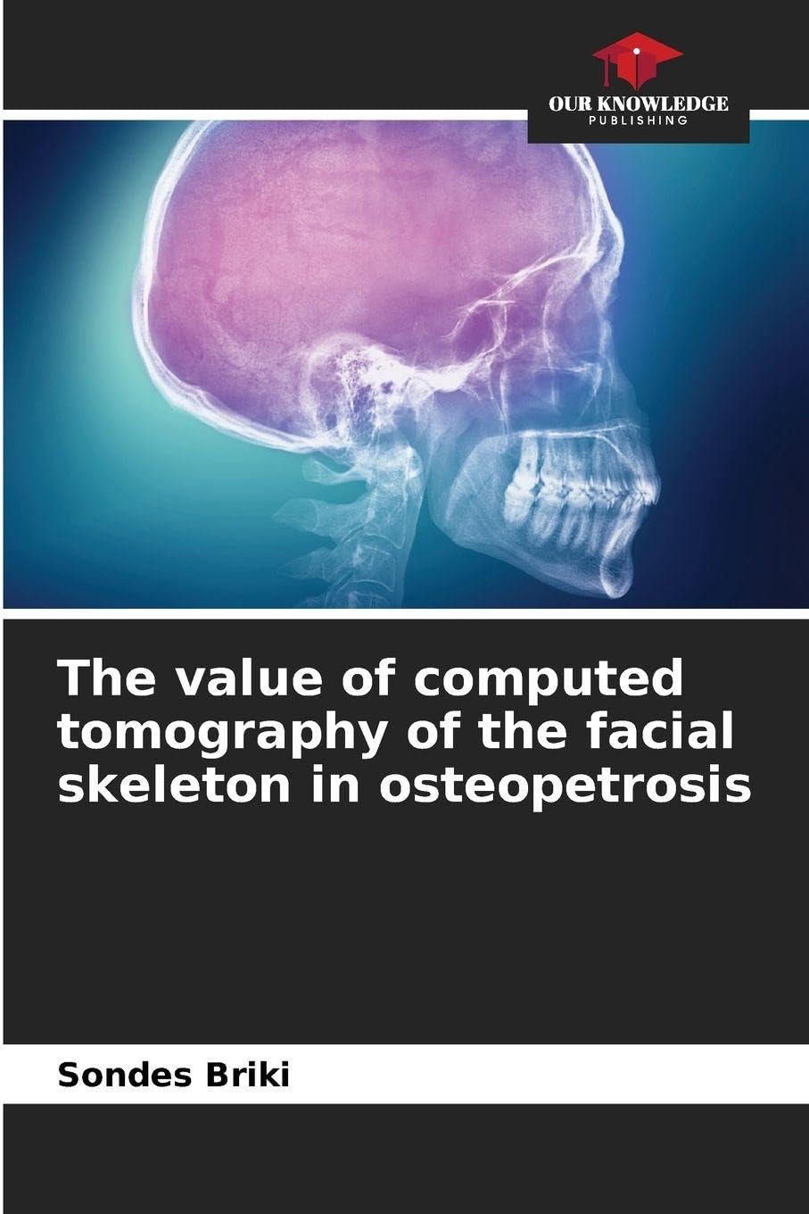 The value of computed tomography of the facial skeleton in osteopetrosis Medicine