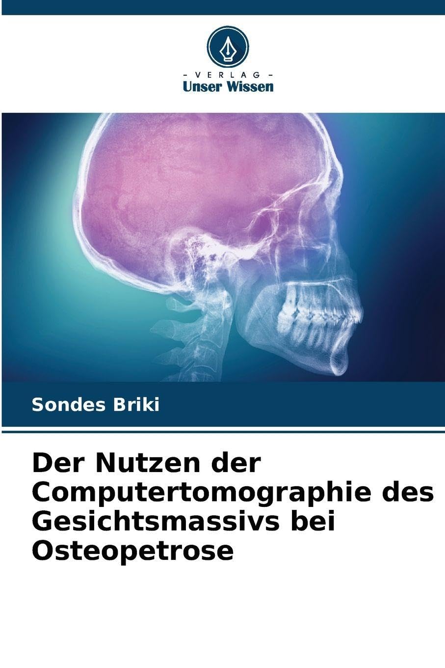 Der Nutzen der Computertomographie des Gesichtsmassivs bei Osteopetrose Medicine