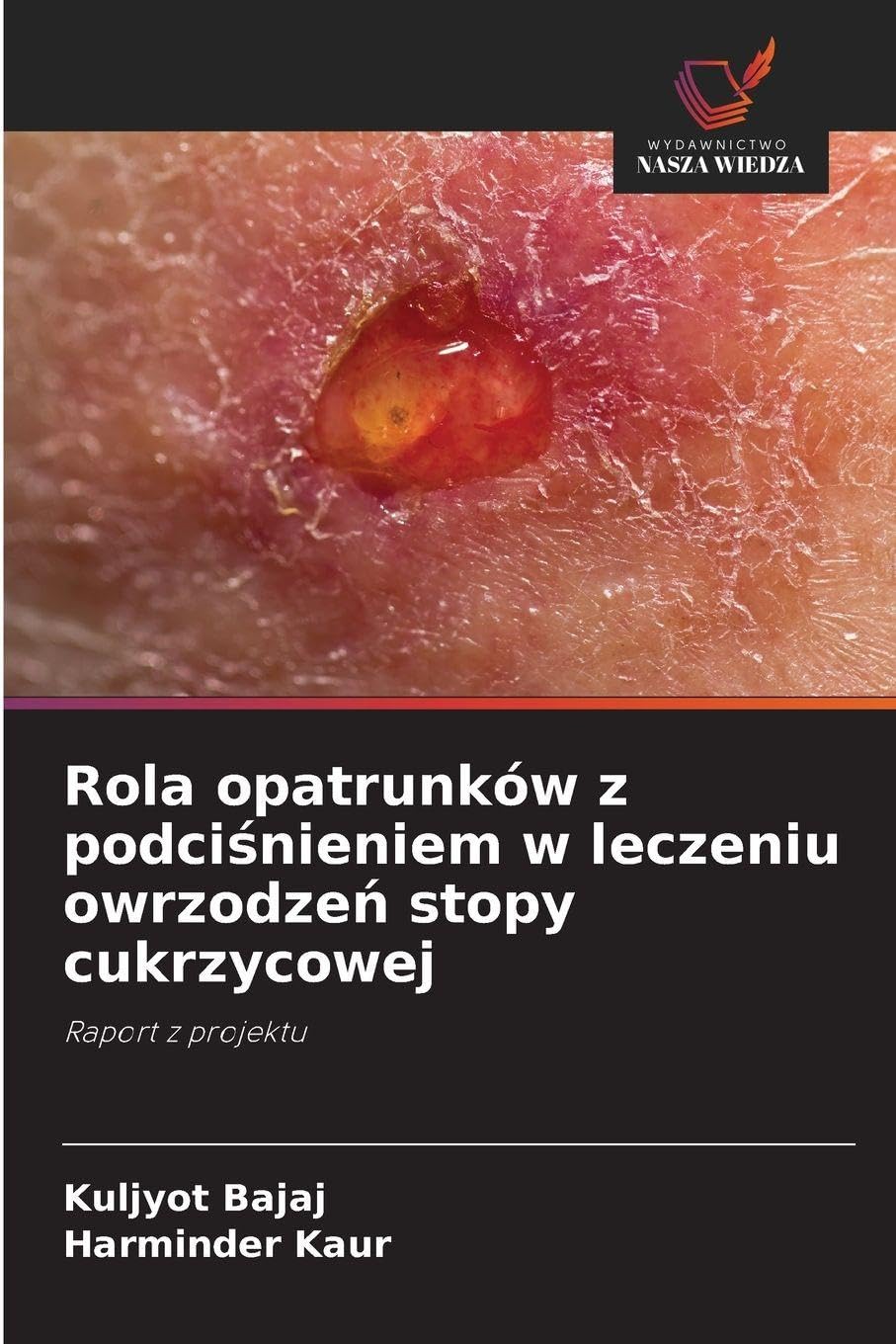 Rola opatrunków z podci¿nieniem w leczeniu owrzodze¿ stopy cukrzycowej Medicine