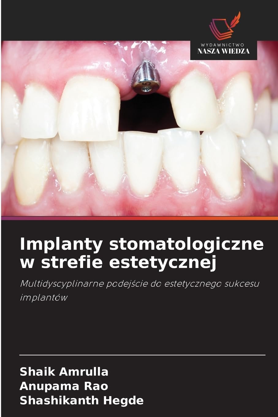 Implanty stomatologiczne w strefie estetycznej Medicine