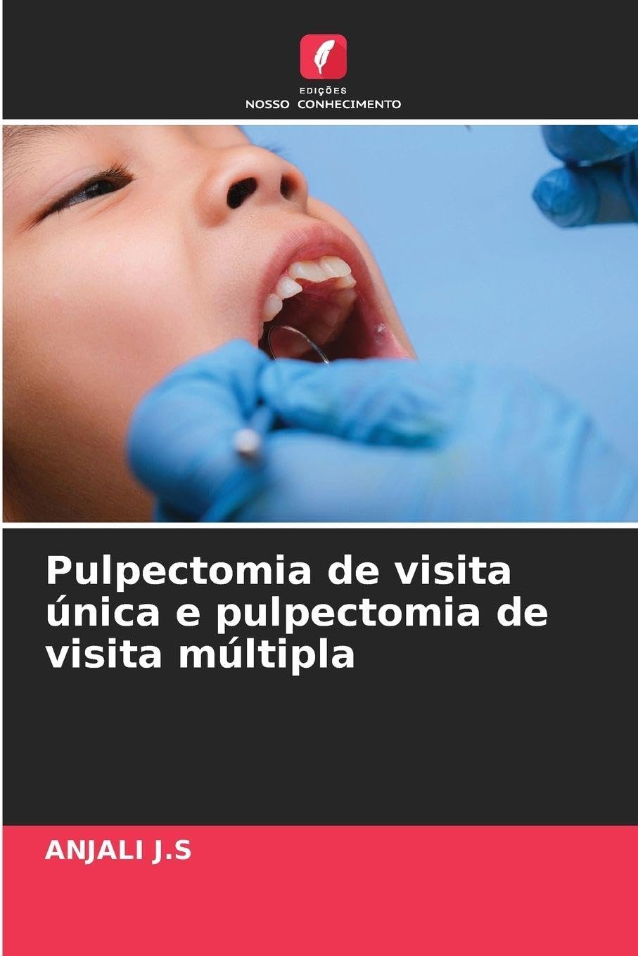 Pulpectomia de visita única e pulpectomia de visita múltipla Medicine
