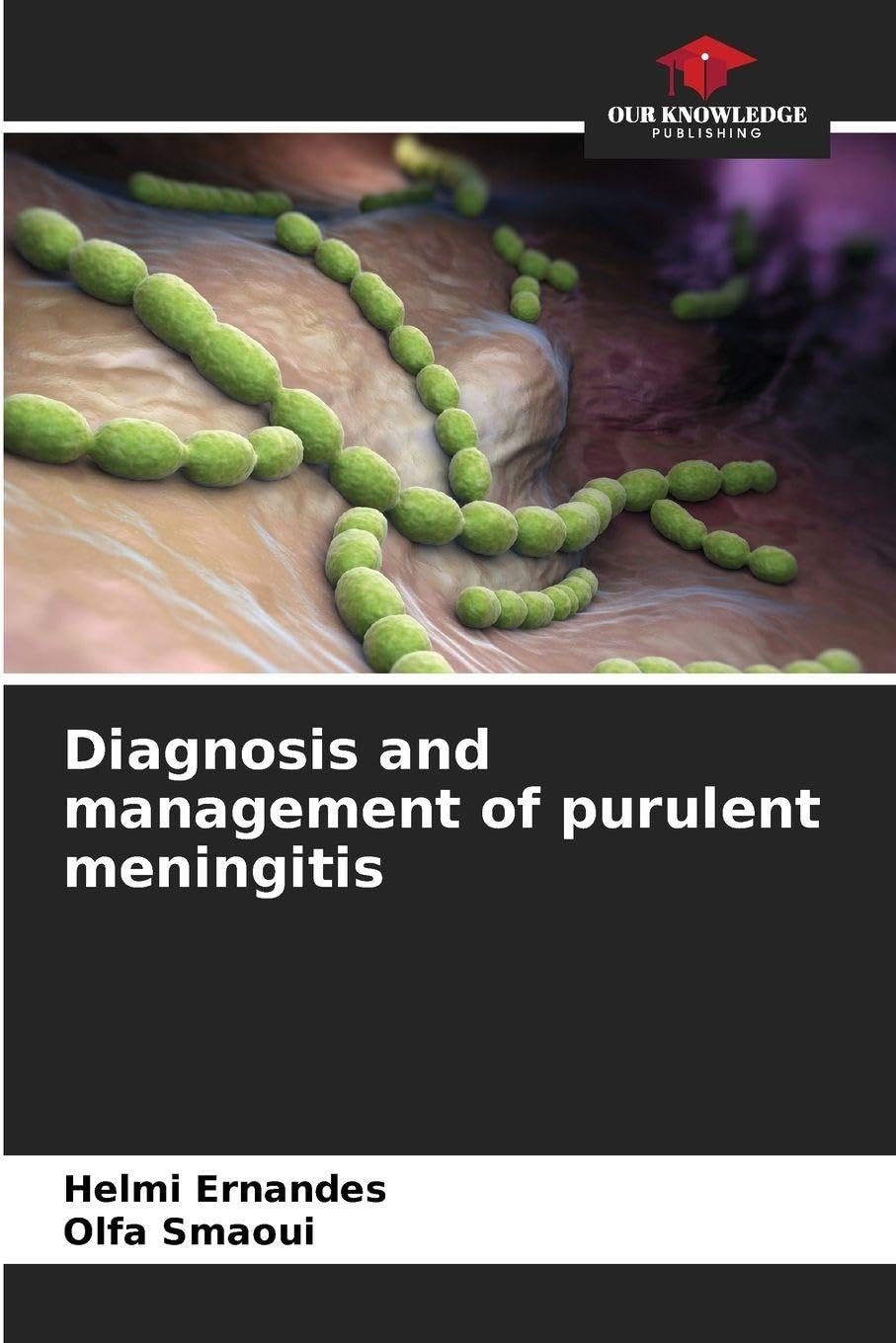 Diagnosis and management of purulent meningitis Medicine