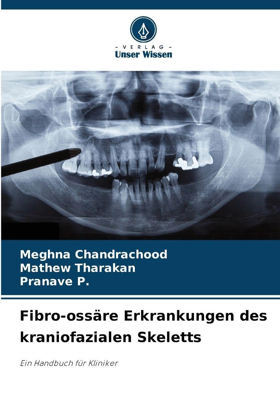 Fibro-ossäre Erkrankungen des kraniofazialen Skeletts Medicine