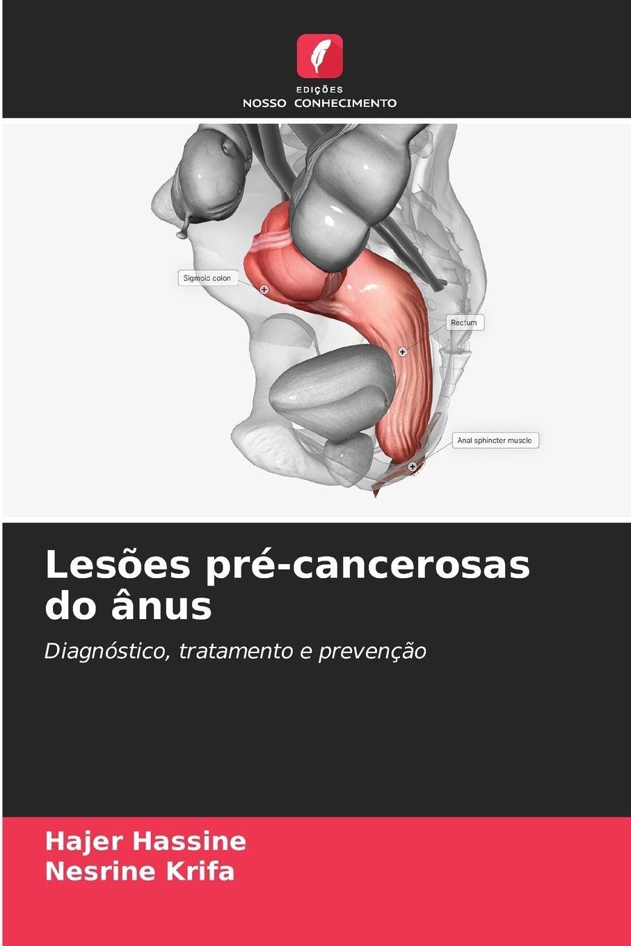 Lesões pré-cancerosas do ânus Medicine