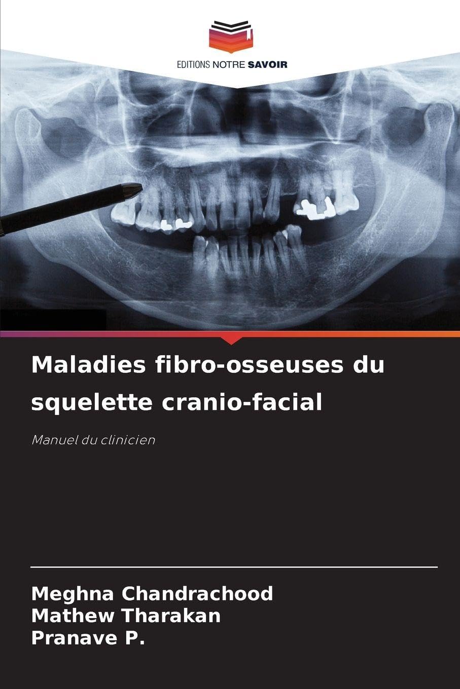 Maladies fibro-osseuses du squelette cranio-facial Medicine