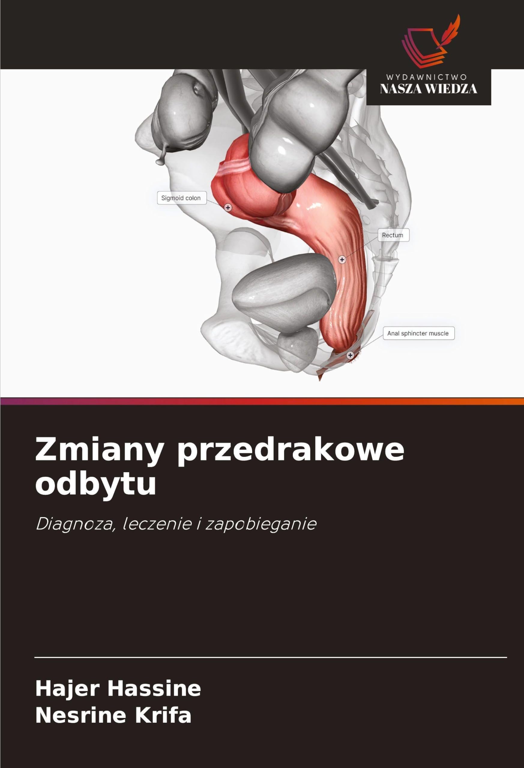 Zmiany przedrakowe odbytu Medicine