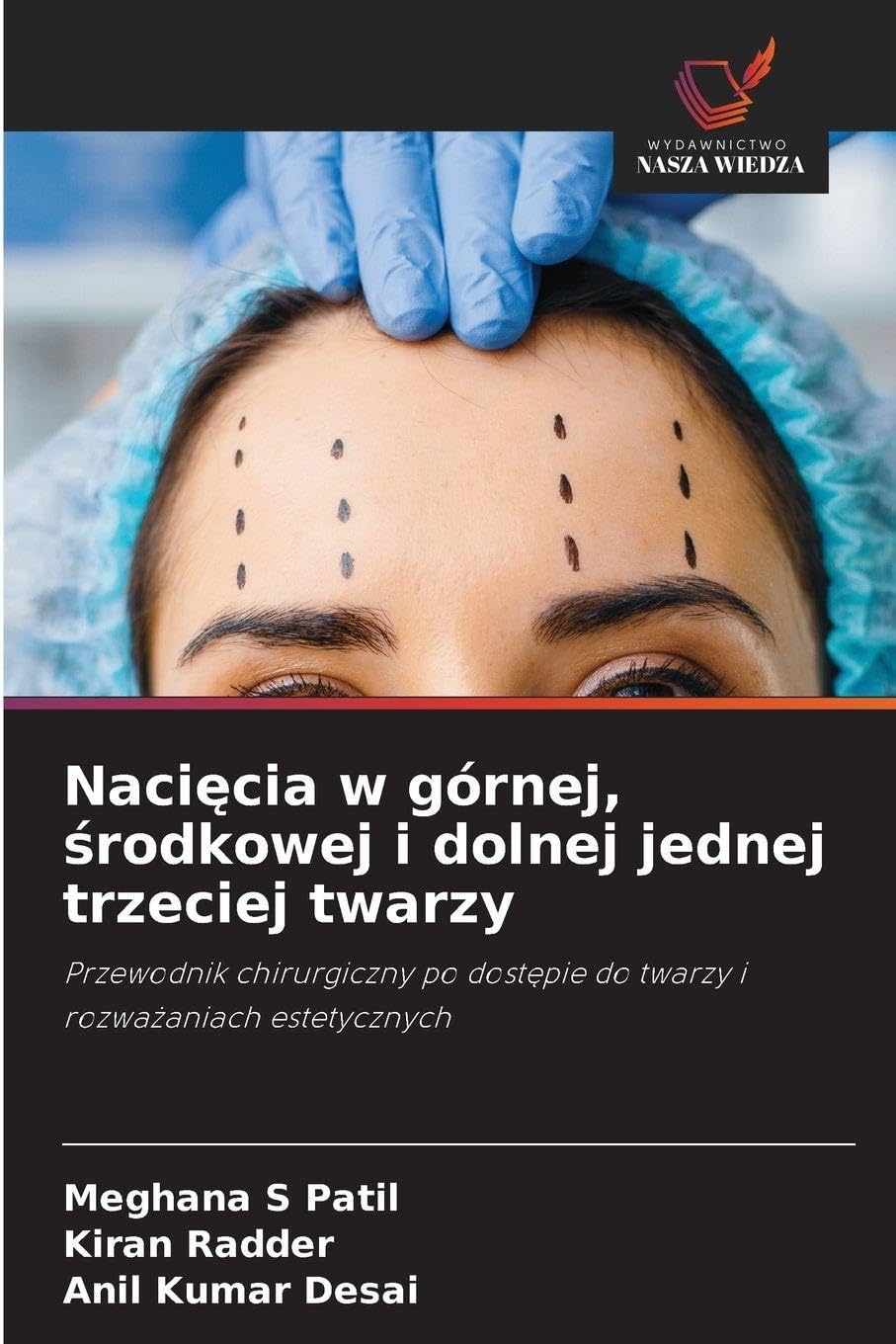 Naci¿cia w górnej, ¿rodkowej i dolnej jednej trzeciej twarzy Medicine