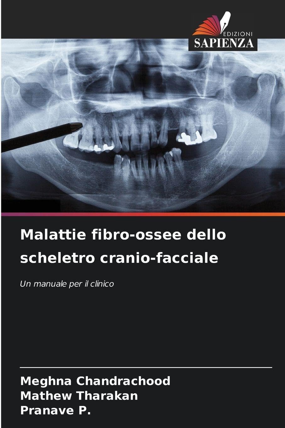 Malattie fibro-ossee dello scheletro cranio-facciale Medicine