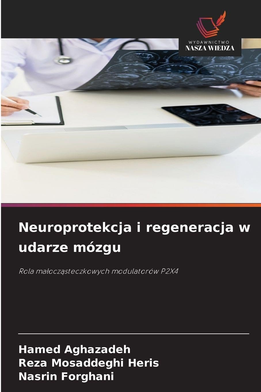 Neuroprotekcja i regeneracja w udarze mózgu Medicine