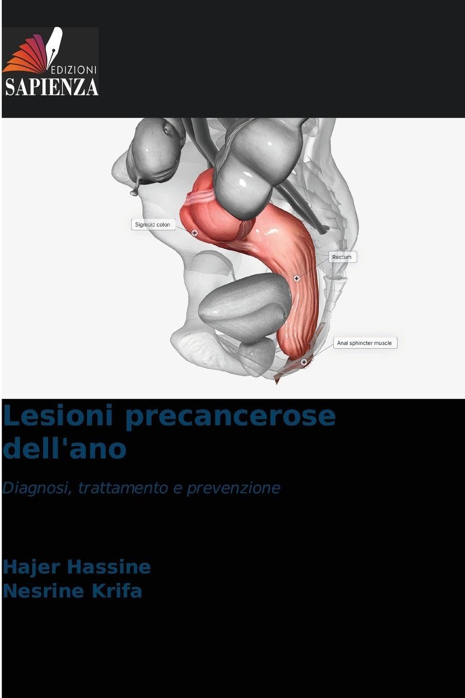 Lesioni precancerose dell'ano Medicine
