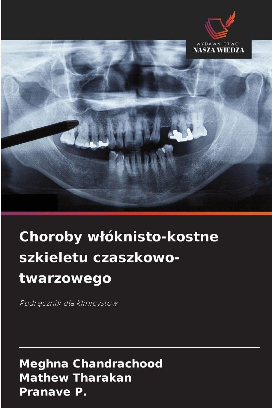 Choroby w¿óknisto-kostne szkieletu czaszkowo-twarzowego Medicine