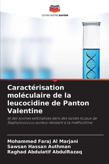 Caractérisation moléculaire de la leucocidine de Panton Valentine Natural Sciences