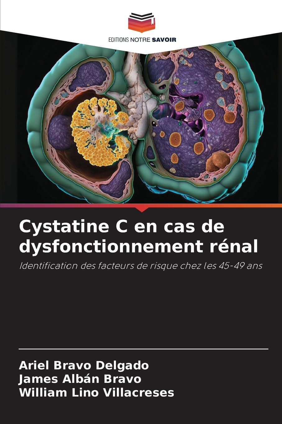 Cystatine C en cas de dysfonctionnement rénal Medicine
