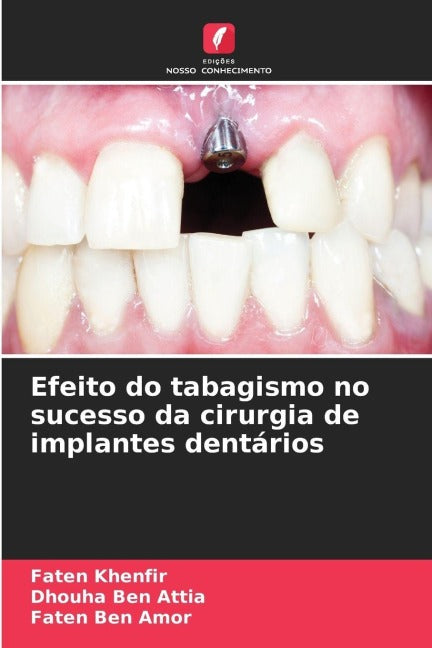 Efeito do tabagismo no sucesso da cirurgia de implantes dentários Medicine