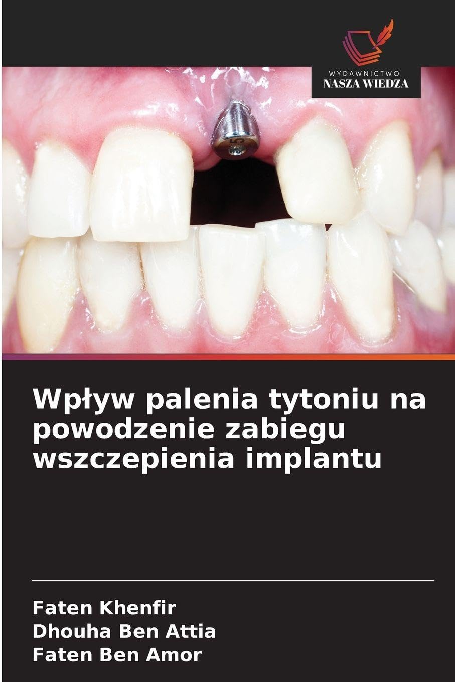 Wp¿yw palenia tytoniu na powodzenie zabiegu wszczepienia implantu Medicine