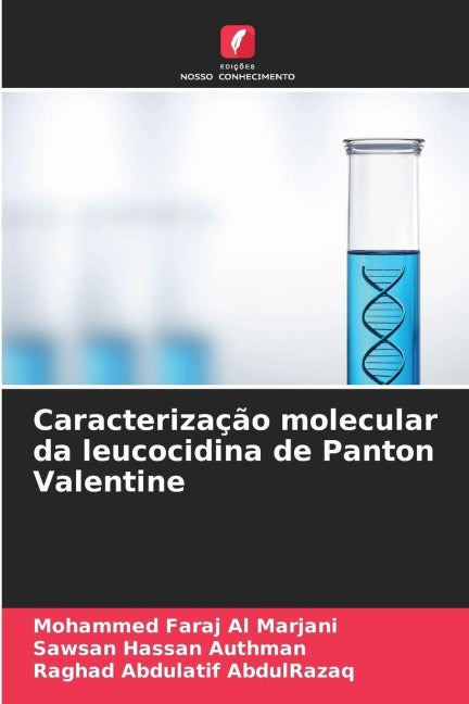 Caracterização molecular da leucocidina de Panton Valentine Natural Sciences
