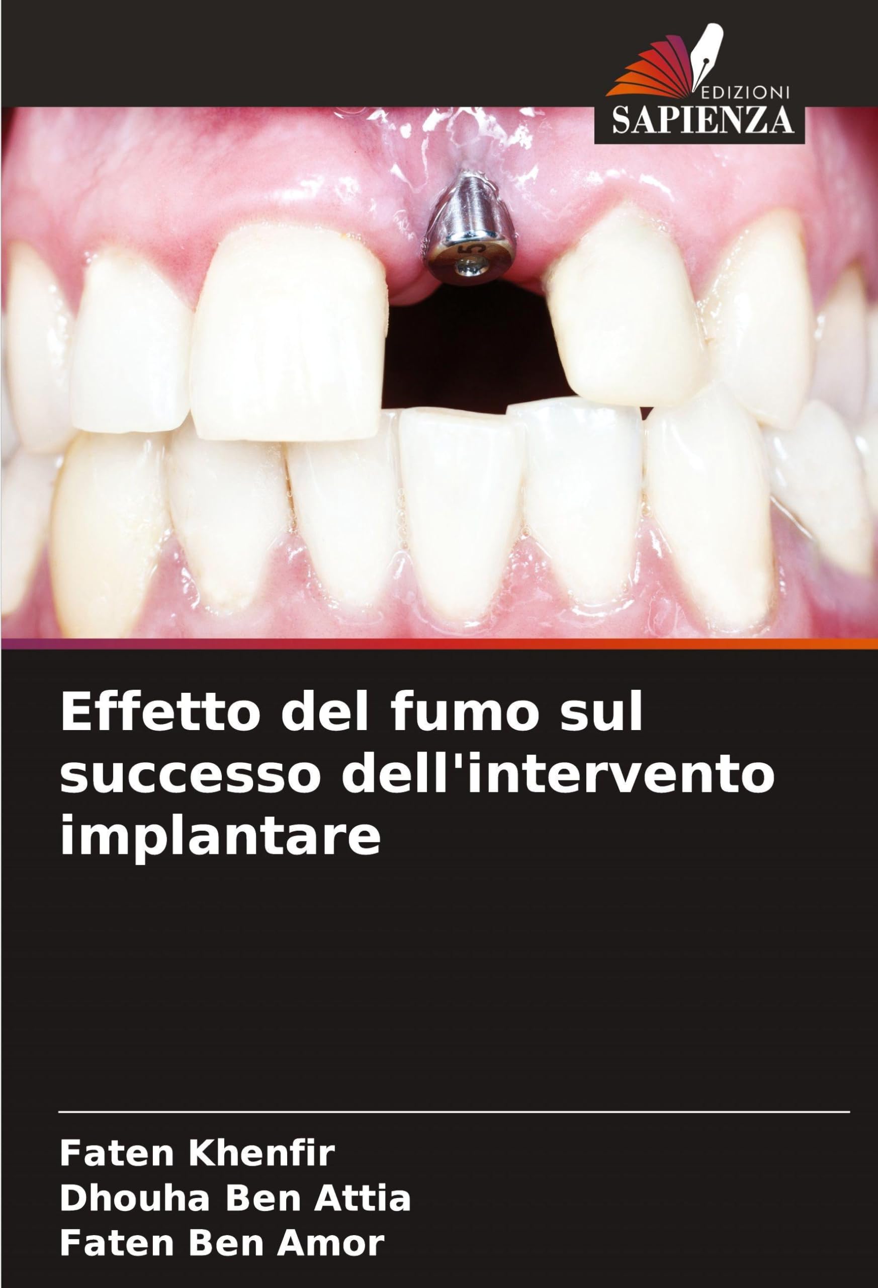 Effetto del fumo sul successo dell'intervento implantare Medicine