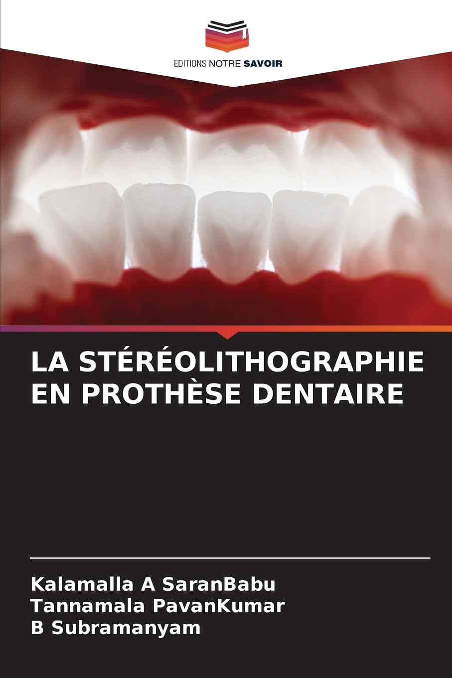 LA STÉRÉOLITHOGRAPHIE EN PROTHÈSE DENTAIRE Medicine