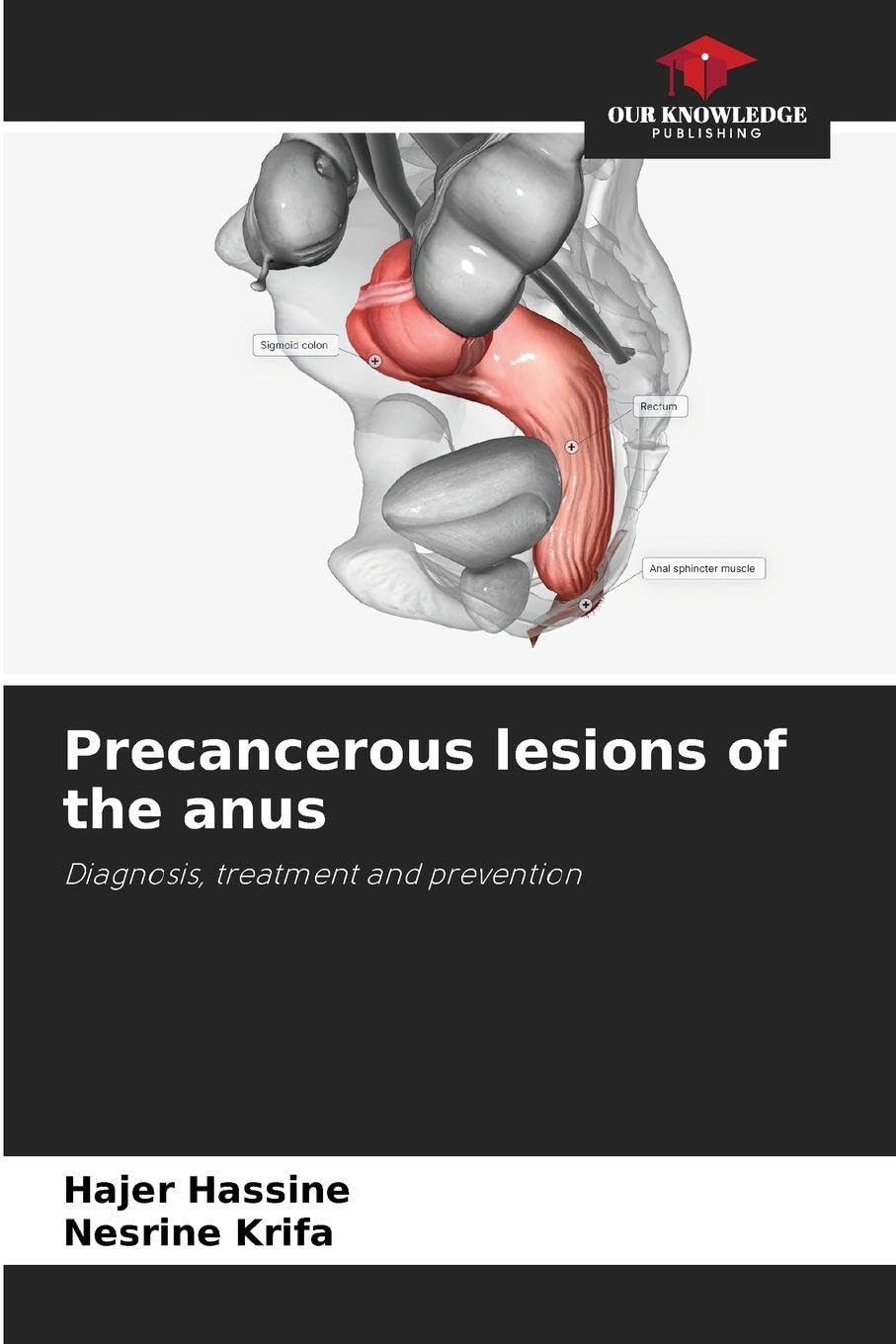 Precancerous lesions of the anus Medicine