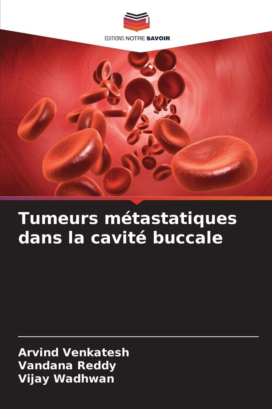 Tumeurs métastatiques dans la cavité buccale: DE Medicine