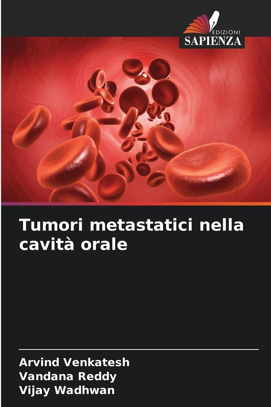 Tumori metastatici nella cavità orale Medicine