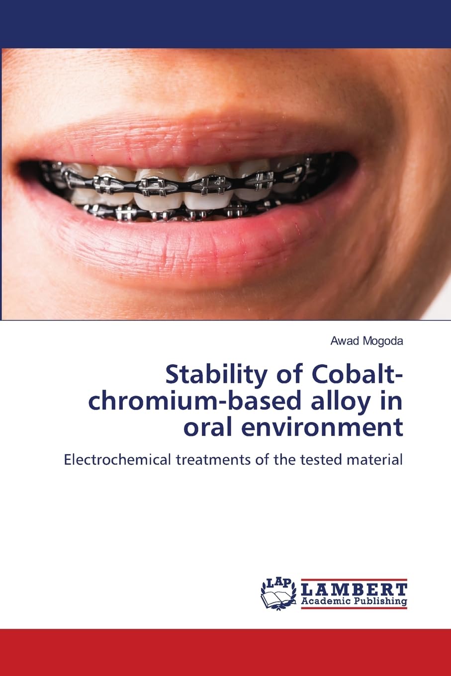 Stability of Cobalt-chromium-based alloy in oral environment Natural Sciences