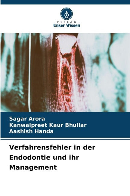 Verfahrensfehler in der Endodontie und ihr Management Medicine