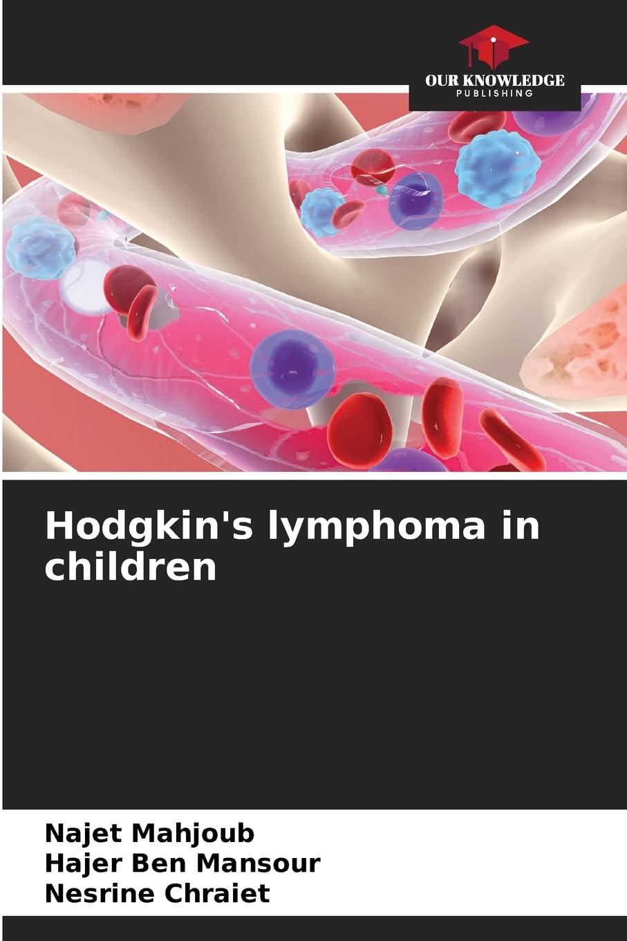 Hodgkin's lymphoma in children Medicine