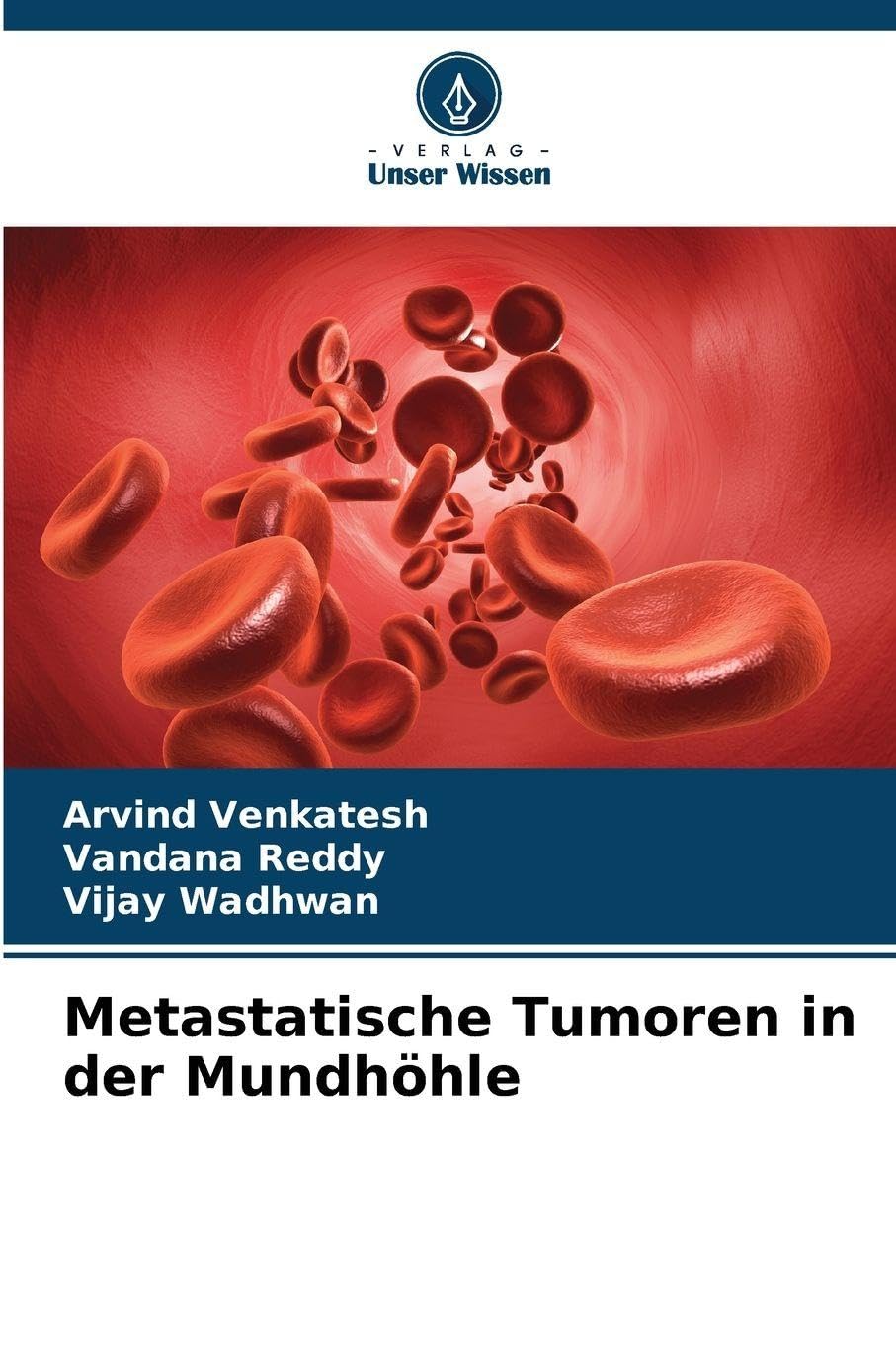 Metastatische Tumoren in der Mundhöhle Medicine