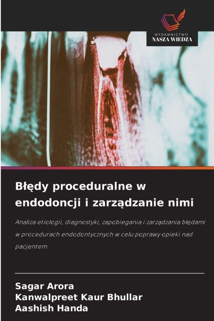 B¿¿dy proceduralne w endodoncji i zarz¿dzanie nimi Medicine