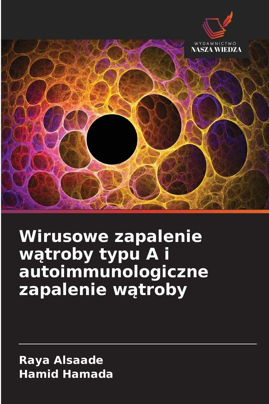 Wirusowe zapalenie w¿troby typu A i autoimmunologiczne zapalenie w¿troby Natural Sciences