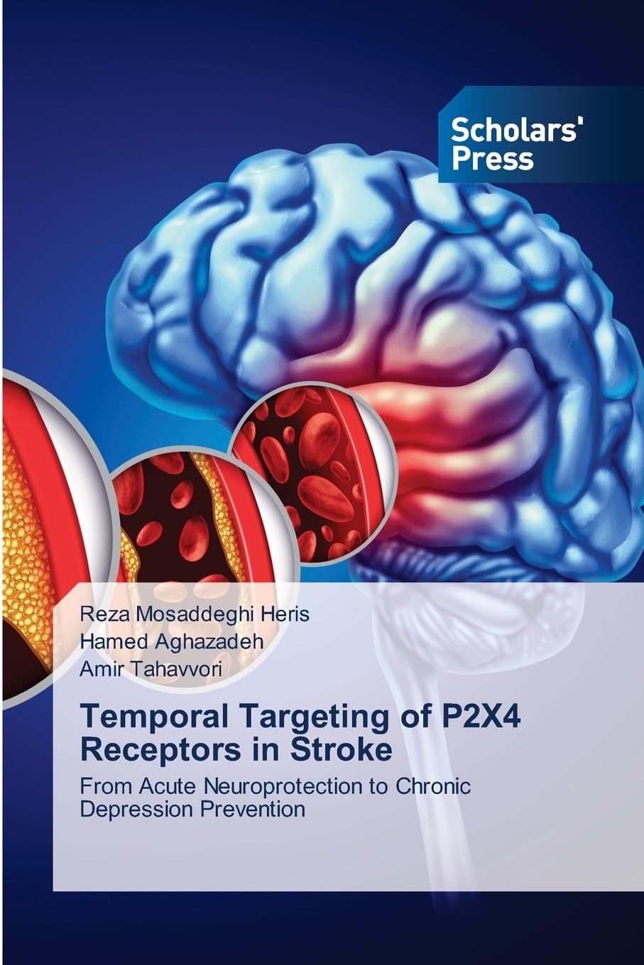 Temporal Targeting of P2X4 Receptors in Stroke Medicine