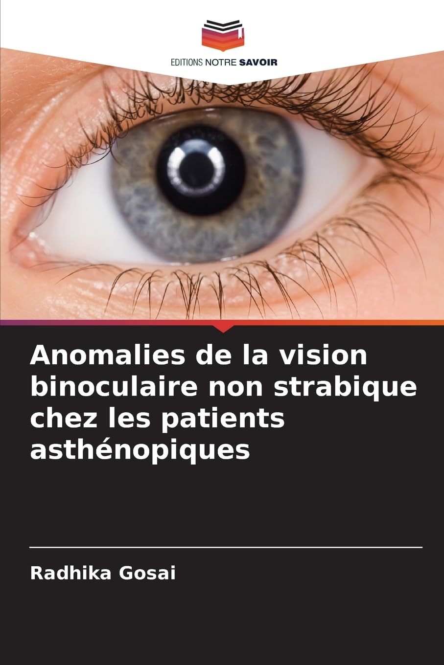 Anomalies de la vision binoculaire non strabique chez les patients asthénopiques Medicine