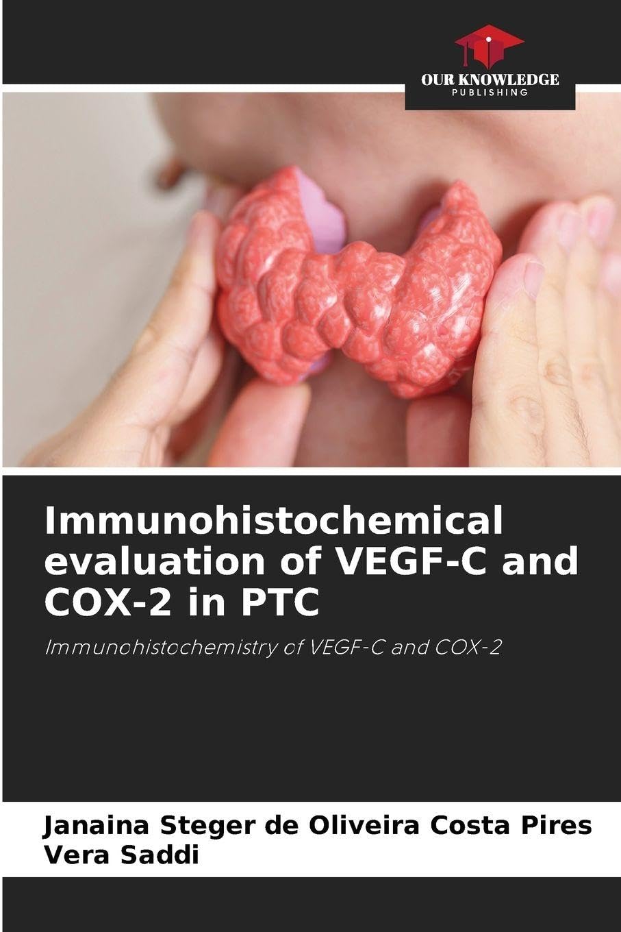 Immunohistochemical evaluation of VEGF-C and COX-2 in PTC Natural Sciences