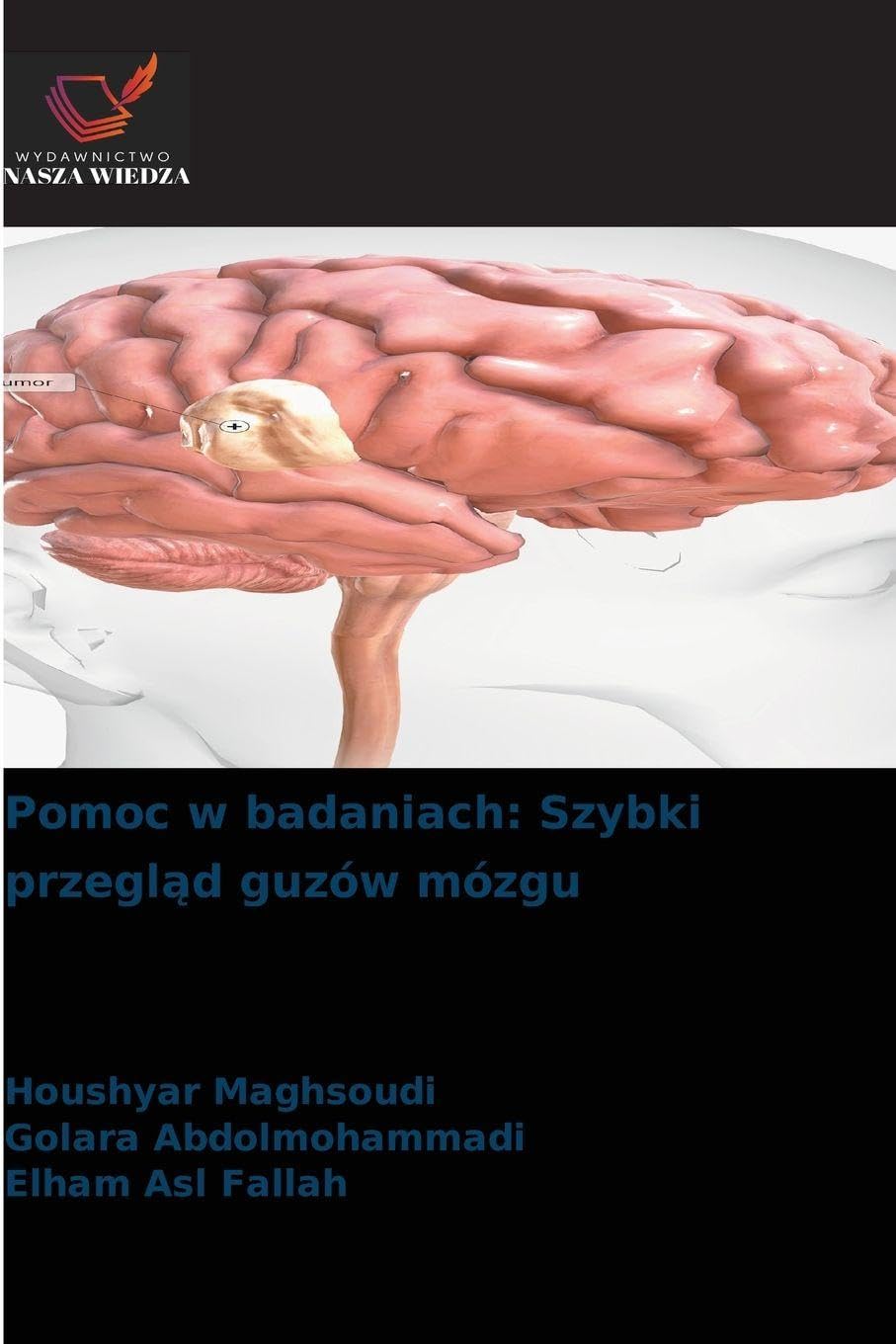 Pomoc w badaniach: Szybki przegl¿d guzów mózgu Medicine
