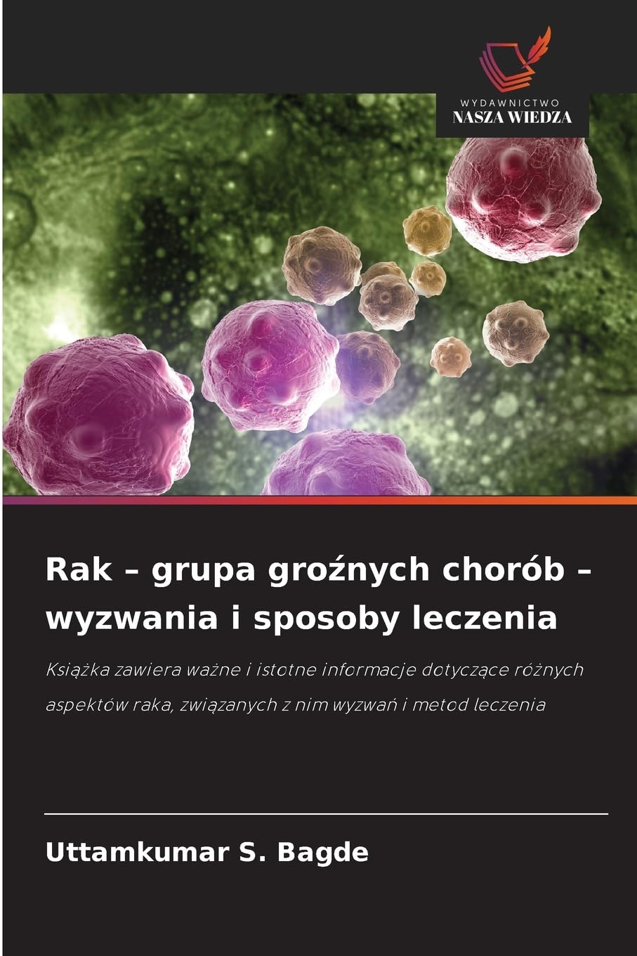 Rak - grupa gro¿nych chorób - wyzwania i sposoby leczenia Medicine