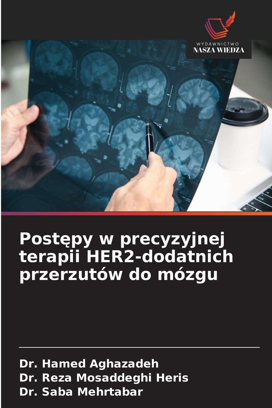 Post¿py w precyzyjnej terapii HER2-dodatnich przerzutów do mózgu Medicine