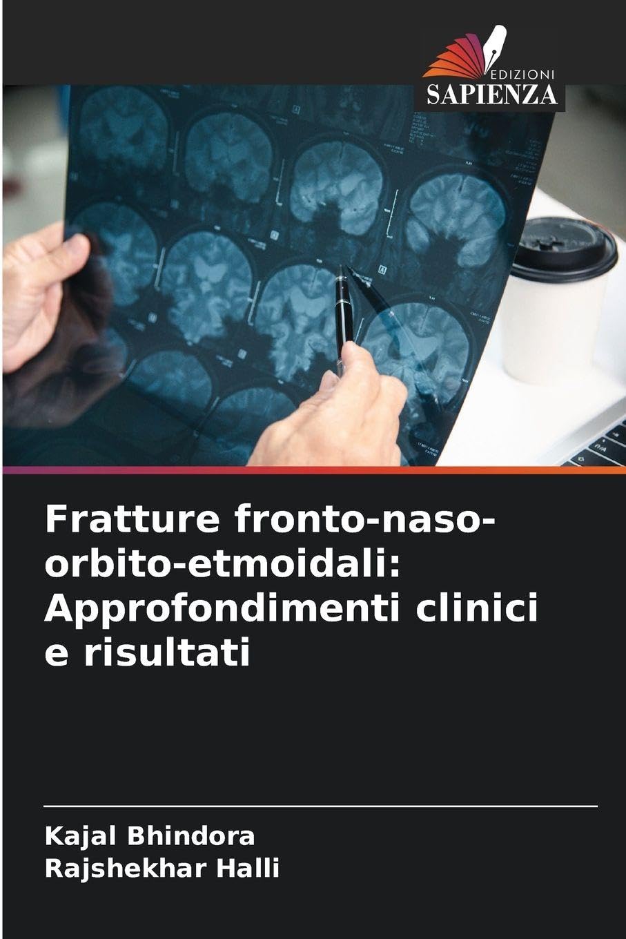 Fratture fronto-naso-orbito-etmoidali: Approfondimenti clinici e risultati Law