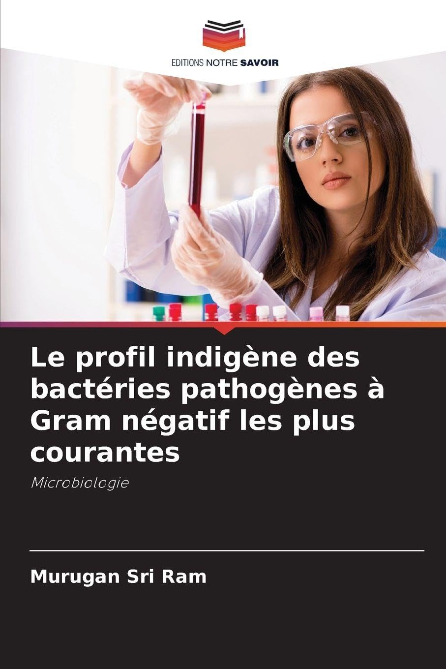 Le profil indigène des bactéries pathogènes à Gram négatif les plus courantes Natural Sciences