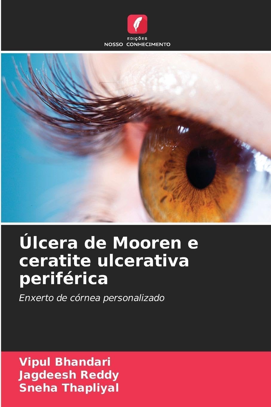 Úlcera de Mooren e ceratite ulcerativa periférica Medicine