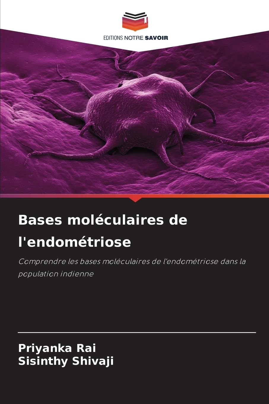 Bases moléculaires de l'endométriose: Comprendre les bases moléculaires de l'endométriose dans la population indienne Natural Sciences