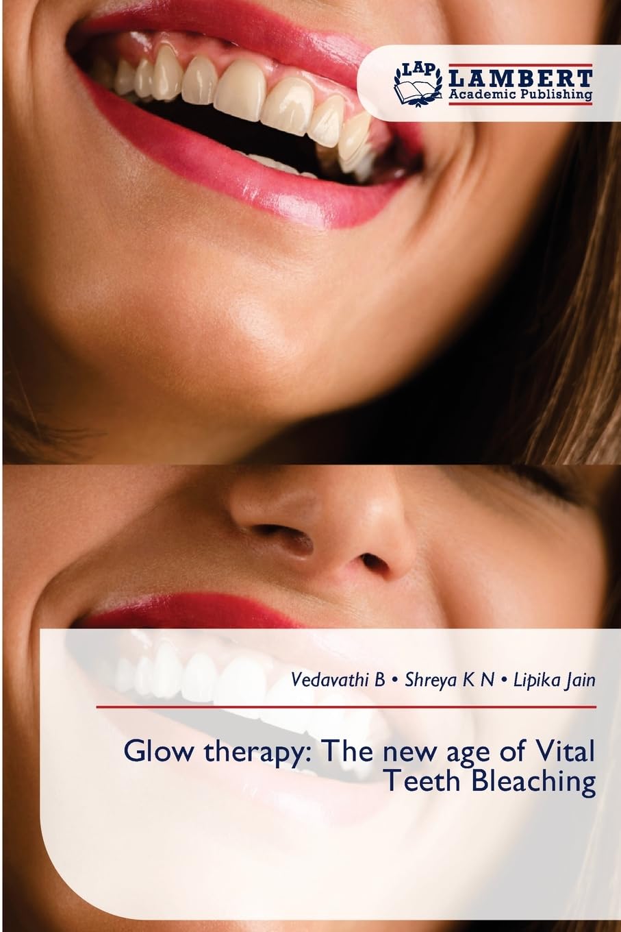 Glow therapy: The new age of Vital Teeth Bleaching Medicine
