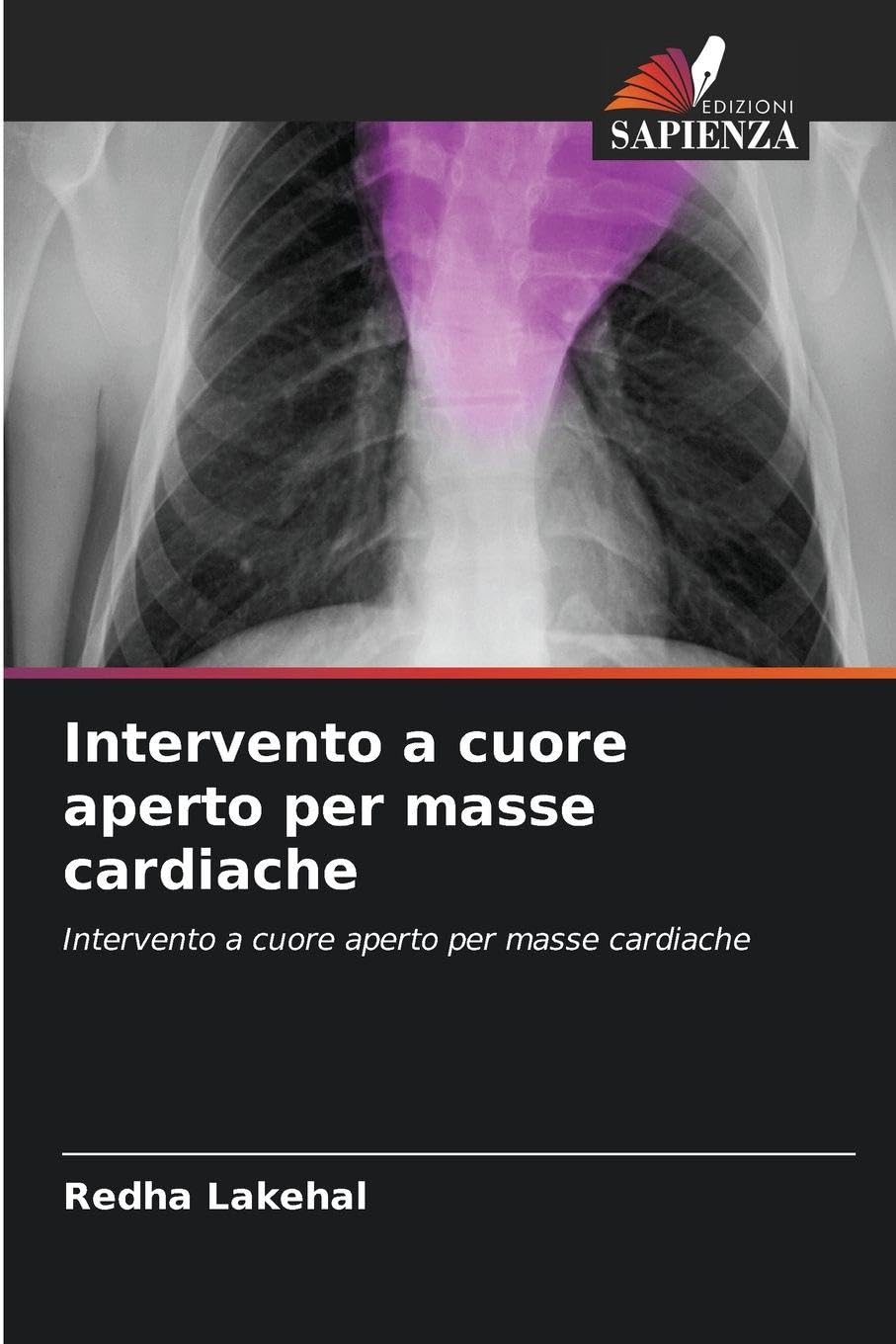 Intervento a cuore aperto per masse cardiache Medicine