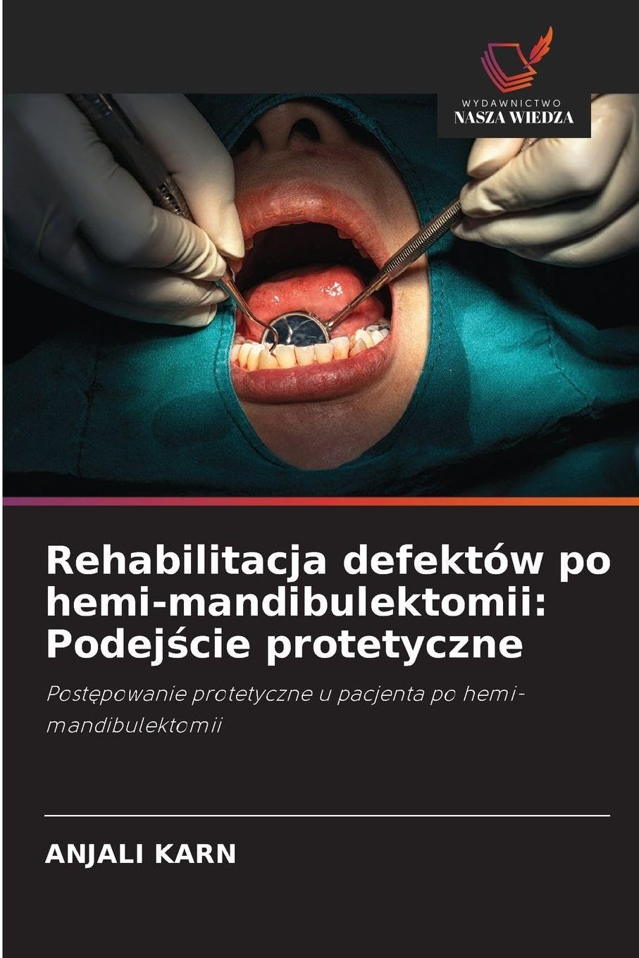 Rehabilitacja defektów po hemi-mandibulektomii: Podej¿cie protetyczne Medicine