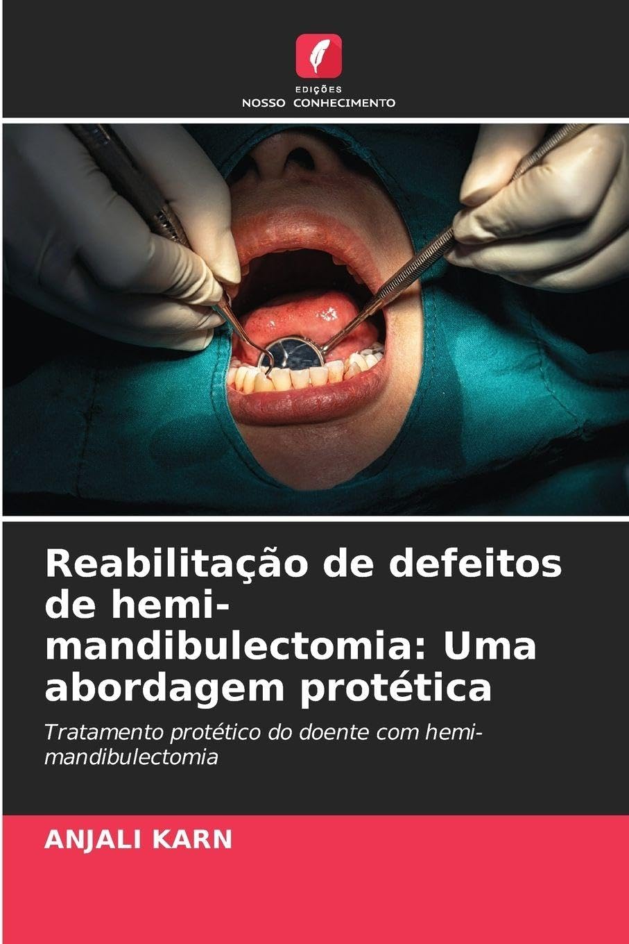 Reabilitação de defeitos de hemi-mandibulectomia: Uma abordagem protética Medicine