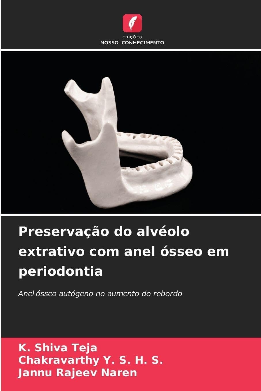 Preservação do alvéolo extrativo com anel ósseo em periodontia Medicine
