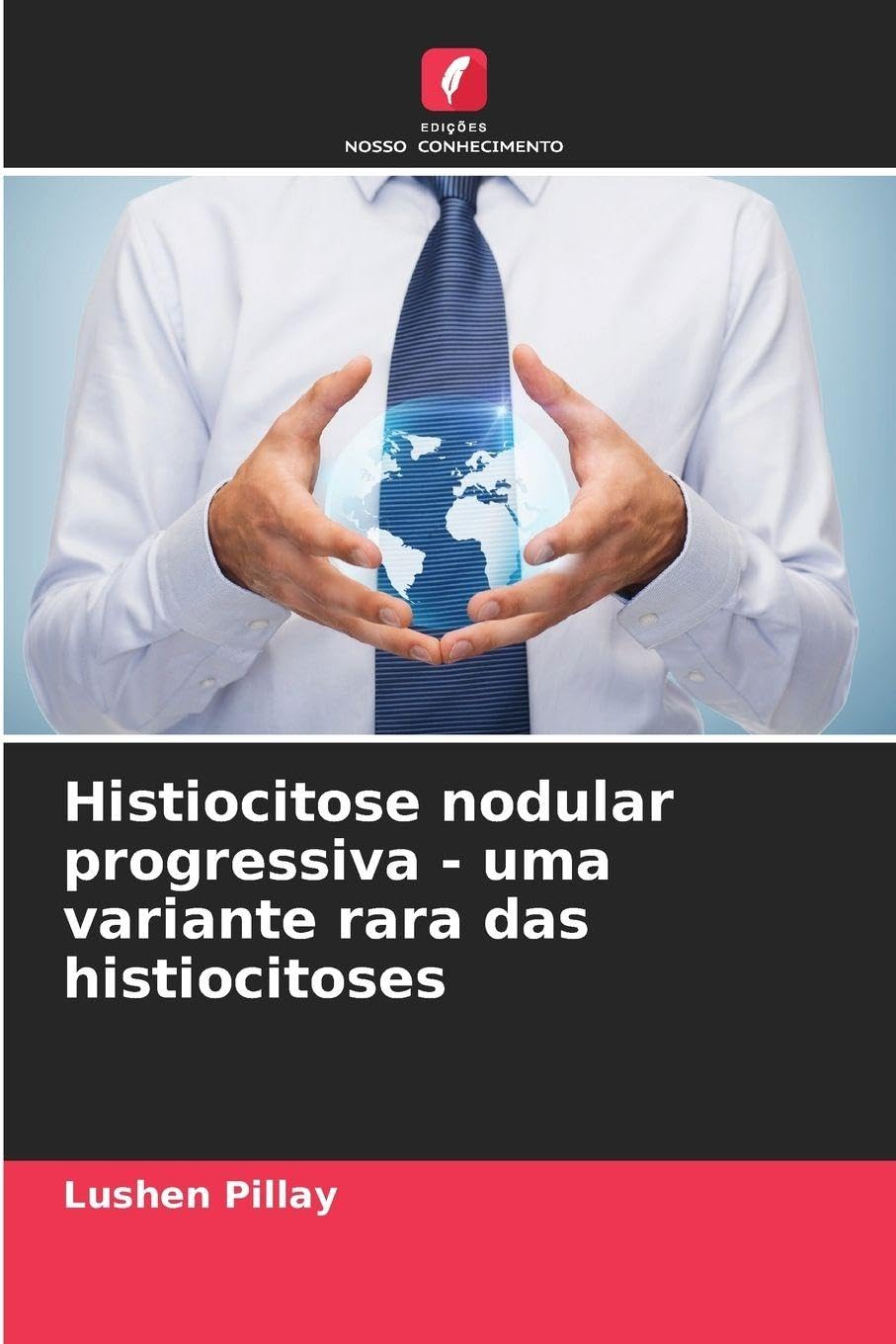 Histiocitose nodular progressiva - uma variante rara das histiocitoses Medicine