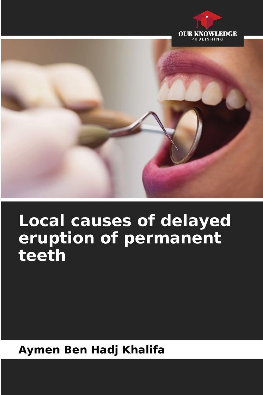 Local causes of delayed eruption of permanent teeth Medicine